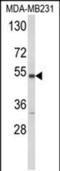 Cytochrome P450 2A13 antibody, PA5-49618, Invitrogen Antibodies, Western Blot image 