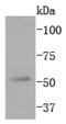 Mitogen-Activated Protein Kinase 10 antibody, NBP2-67800, Novus Biologicals, Western Blot image 