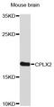 Complexin 2 antibody, STJ23212, St John
