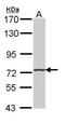Hedgehog Interacting Protein antibody, orb73695, Biorbyt, Western Blot image 