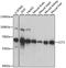 Chaperonin Containing TCP1 Subunit 3 antibody, A6547, ABclonal Technology, Western Blot image 