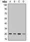 N(Alpha)-Acetyltransferase 10, NatA Catalytic Subunit antibody, LS-C667919, Lifespan Biosciences, Western Blot image 