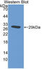 Integrin Subunit Alpha D antibody, LS-C314448, Lifespan Biosciences, Western Blot image 