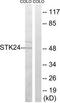 Serine/Threonine Kinase 24 antibody, TA314747, Origene, Western Blot image 
