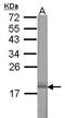 Vesicle Associated Membrane Protein 2 antibody, LS-B11706, Lifespan Biosciences, Western Blot image 