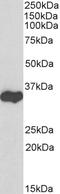 GAPDH antibody, STJ70553, St John