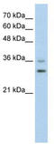 Forkhead Box Q1 antibody, TA334252, Origene, Western Blot image 
