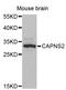 Calpain Small Subunit 2 antibody, STJ114270, St John