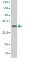 Bardet-Biedl Syndrome 7 antibody, H00055212-M01, Novus Biologicals, Western Blot image 