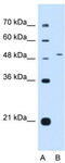 DAX1 antibody, TA346491, Origene, Western Blot image 