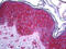 c-Kit antibody, 51-921, ProSci, Immunohistochemistry frozen image 