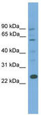 BAF Chromatin Remodeling Complex Subunit BCL7A antibody, TA344743, Origene, Western Blot image 