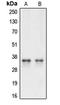 Caspase 3 antibody, LS-C351919, Lifespan Biosciences, Western Blot image 