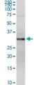 3-mercaptopyruvate sulfurtransferase antibody, H00004357-D01P, Novus Biologicals, Western Blot image 
