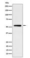 Immunoglobulin Heavy Constant Gamma 1 (G1m Marker) antibody, M04575-6, Boster Biological Technology, Western Blot image 