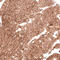Laminin Subunit Alpha 2 antibody, AMAb91166, Atlas Antibodies, Immunohistochemistry frozen image 