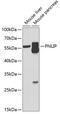 Pancreatic Lipase antibody, 22-186, ProSci, Western Blot image 