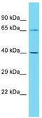 Dorsal Inhibitory Axon Guidance Protein antibody, TA334876, Origene, Western Blot image 