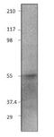 E2F Transcription Factor 2 antibody, GTX47813, GeneTex, Western Blot image 