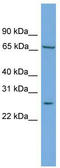 Mediator Complex Subunit 7 antibody, TA344541, Origene, Western Blot image 
