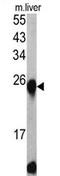 ETHE1 Persulfide Dioxygenase antibody, AP17351PU-N, Origene, Western Blot image 