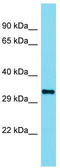Olfactory receptor 110 antibody, TA333493, Origene, Western Blot image 