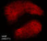 Vasodilator Stimulated Phosphoprotein antibody, VM2771, ECM Biosciences, Immunocytochemistry image 