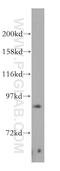 Poly(ADP-Ribose) Polymerase Family Member 9 antibody, 17535-1-AP, Proteintech Group, Western Blot image 