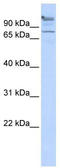 Zinc Finger And BTB Domain Containing 49 antibody, TA330198, Origene, Western Blot image 
