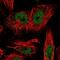 LDL Receptor Related Protein 5 Like antibody, NBP1-90543, Novus Biologicals, Immunofluorescence image 