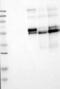Complement C2 antibody, LS-B15378, Lifespan Biosciences, Western Blot image 