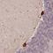 Ribosomal Protein S3A antibody, NBP2-13264, Novus Biologicals, Immunohistochemistry paraffin image 