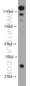 Spindlin Family Member 2B antibody, 10107-2-AP, Proteintech Group, Western Blot image 