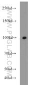 Matrix Extracellular Phosphoglycoprotein antibody, 23256-1-AP, Proteintech Group, Western Blot image 
