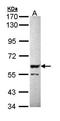 Serine/threonine-protein phosphatase 2B catalytic subunit beta isoform antibody, orb73682, Biorbyt, Western Blot image 