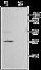 Potassium Voltage-Gated Channel Subfamily J Member 11 antibody, GTX54777, GeneTex, Western Blot image 