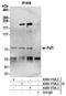PAF1 Homolog, Paf1/RNA Polymerase II Complex Component antibody, A300-173A, Bethyl Labs, Immunoprecipitation image 