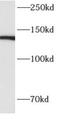 Alpha Kinase 1 antibody, FNab00346, FineTest, Western Blot image 