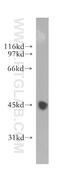 Leucine Rich Alpha-2-Glycoprotein 1 antibody, 13224-1-AP, Proteintech Group, Western Blot image 