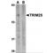 Tripartite Motif Containing 25 antibody, MBS150891, MyBioSource, Western Blot image 