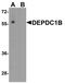 DEP Domain Containing 1B antibody, PA5-72875, Invitrogen Antibodies, Western Blot image 