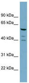 RAB Guanine Nucleotide Exchange Factor 1 antibody, TA334545, Origene, Western Blot image 