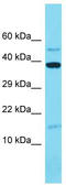 Mitochondrial Ribosomal Protein L14 antibody, TA330716, Origene, Western Blot image 
