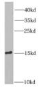 SH2 Domain Containing 1A antibody, FNab07819, FineTest, Western Blot image 