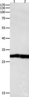 Dual specificity protein phosphatase 6 antibody, TA323083, Origene, Western Blot image 