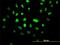 Vacuolar Protein Sorting 25 Homolog antibody, H00084313-M01, Novus Biologicals, Immunocytochemistry image 