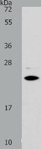 Superoxide Dismutase 2 antibody, TA321188, Origene, Western Blot image 