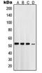 Presenilin 1 antibody, orb214465, Biorbyt, Western Blot image 