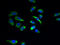Sodium/Potassium Transporting ATPase Interacting 4 antibody, A66154-100, Epigentek, Immunofluorescence image 