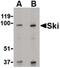 SKI Proto-Oncogene antibody, PA5-20307, Invitrogen Antibodies, Western Blot image 